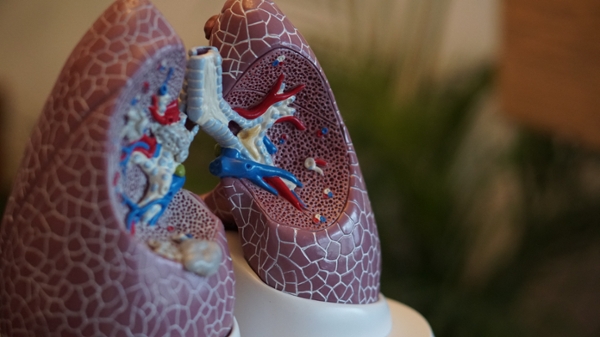 Medical model of lungs. 