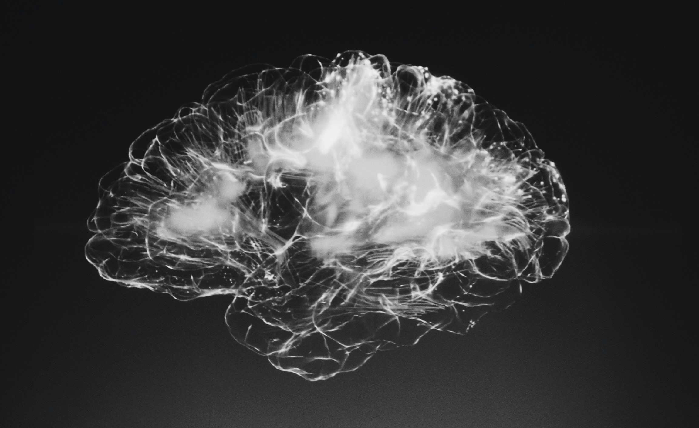 Brain scan in black and white. 