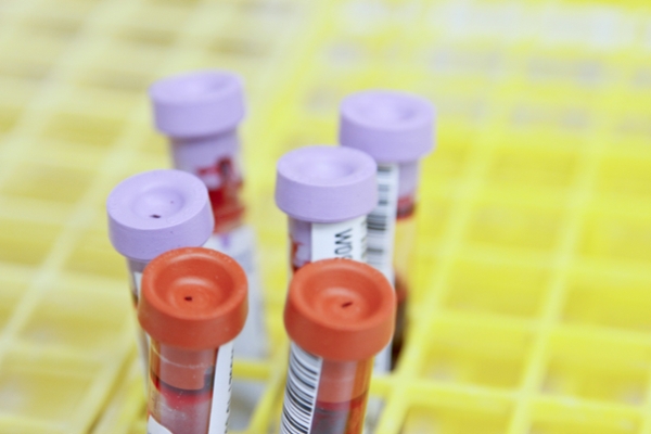 Vials of blood in a research lab. 